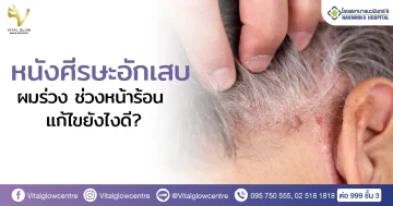 หนังศีรษะอักเสบ ผมร่วง-seborrheic dermatitis