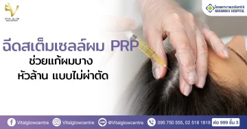 ฉีดสเต็มเซลล์ผม PRP