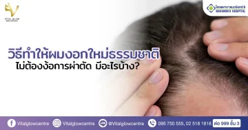 วิธีทําให้ผมงอกใหม่ ธรรมชาติ ไม่ต้องง้อการผ่าตัด มีอะไรบ้าง?