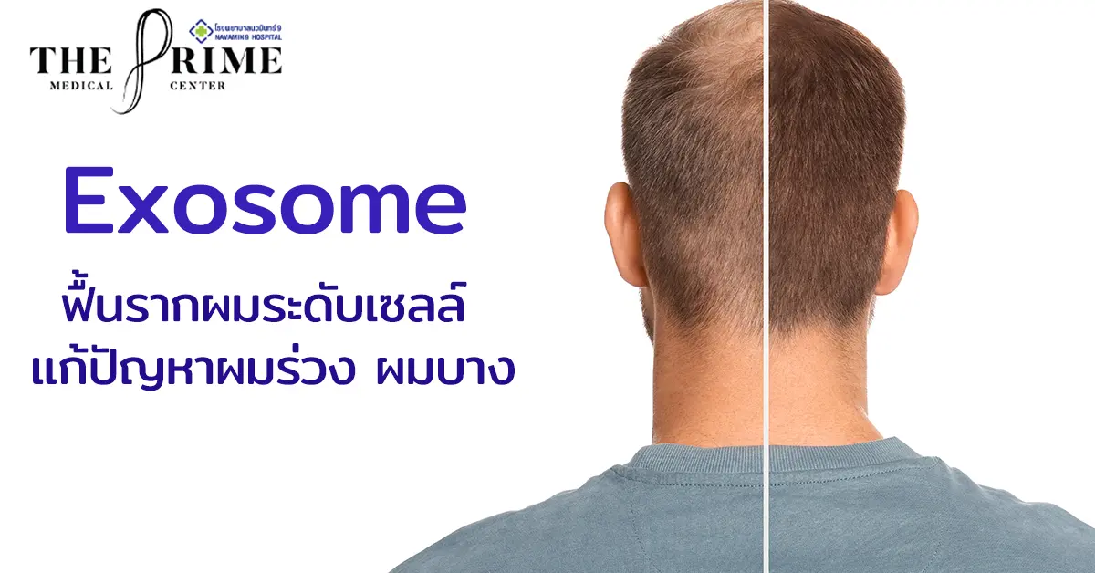 บริการ Exosome